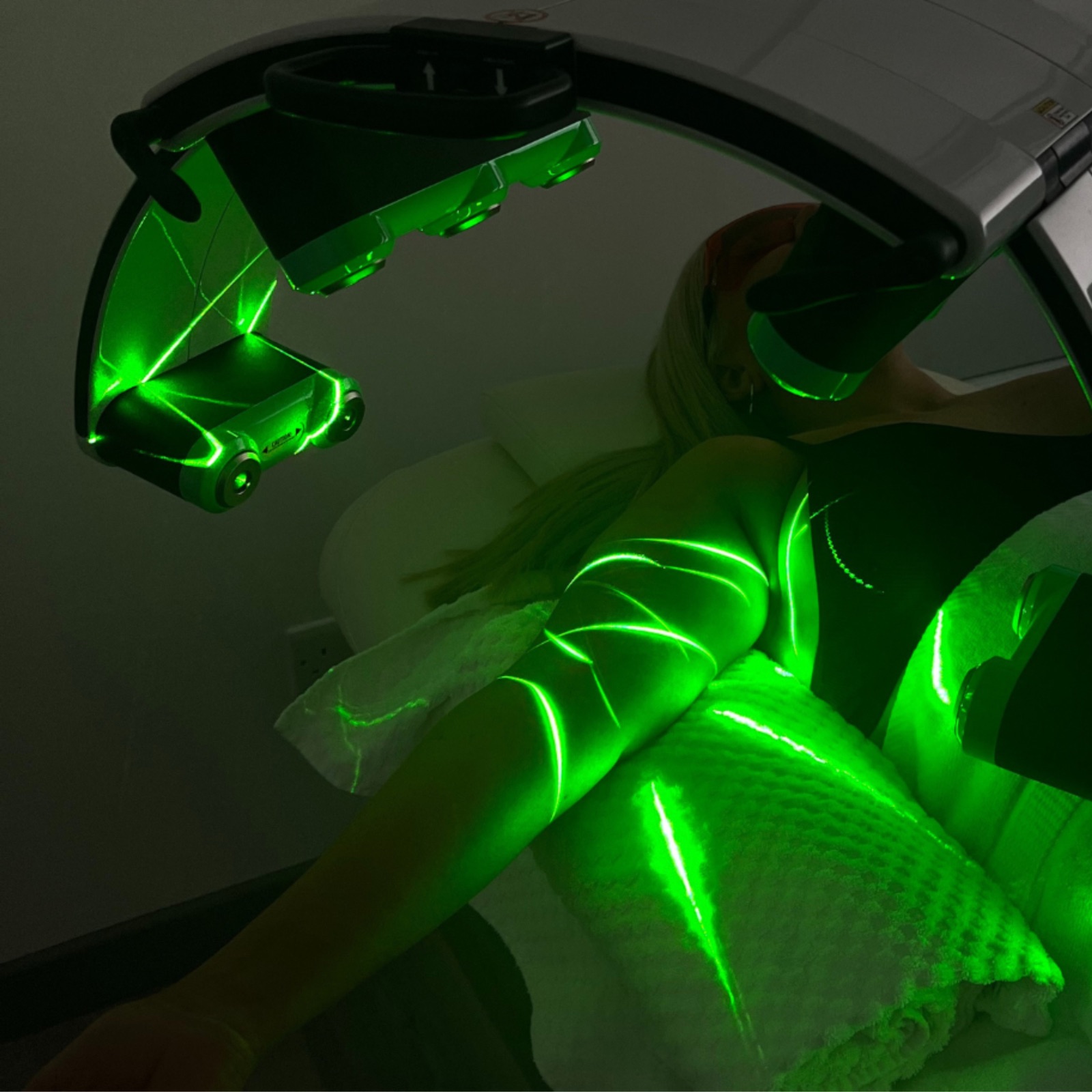 Emerald Laser-behandling av armar med grönt laserljus – HBC Borås