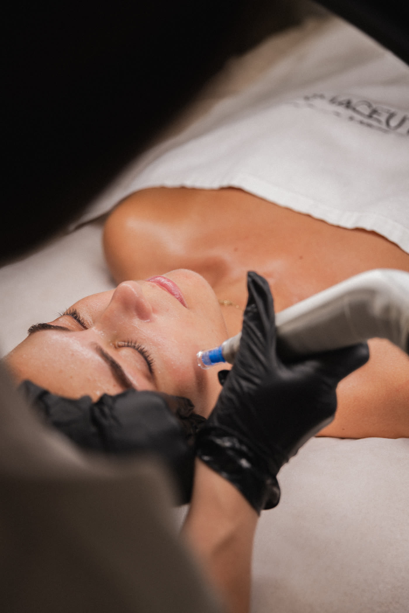 Dermapen 4 microneedling-behandling på HBC i Borås