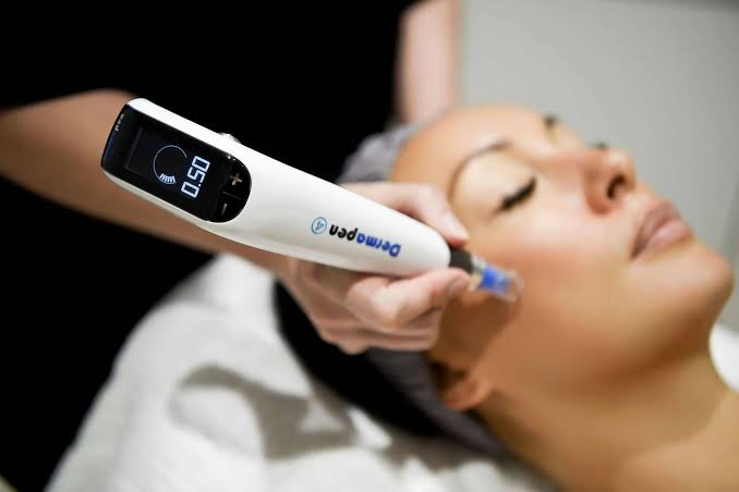 Dermapen 4 microneedling av ansiktet på HBC i Borås