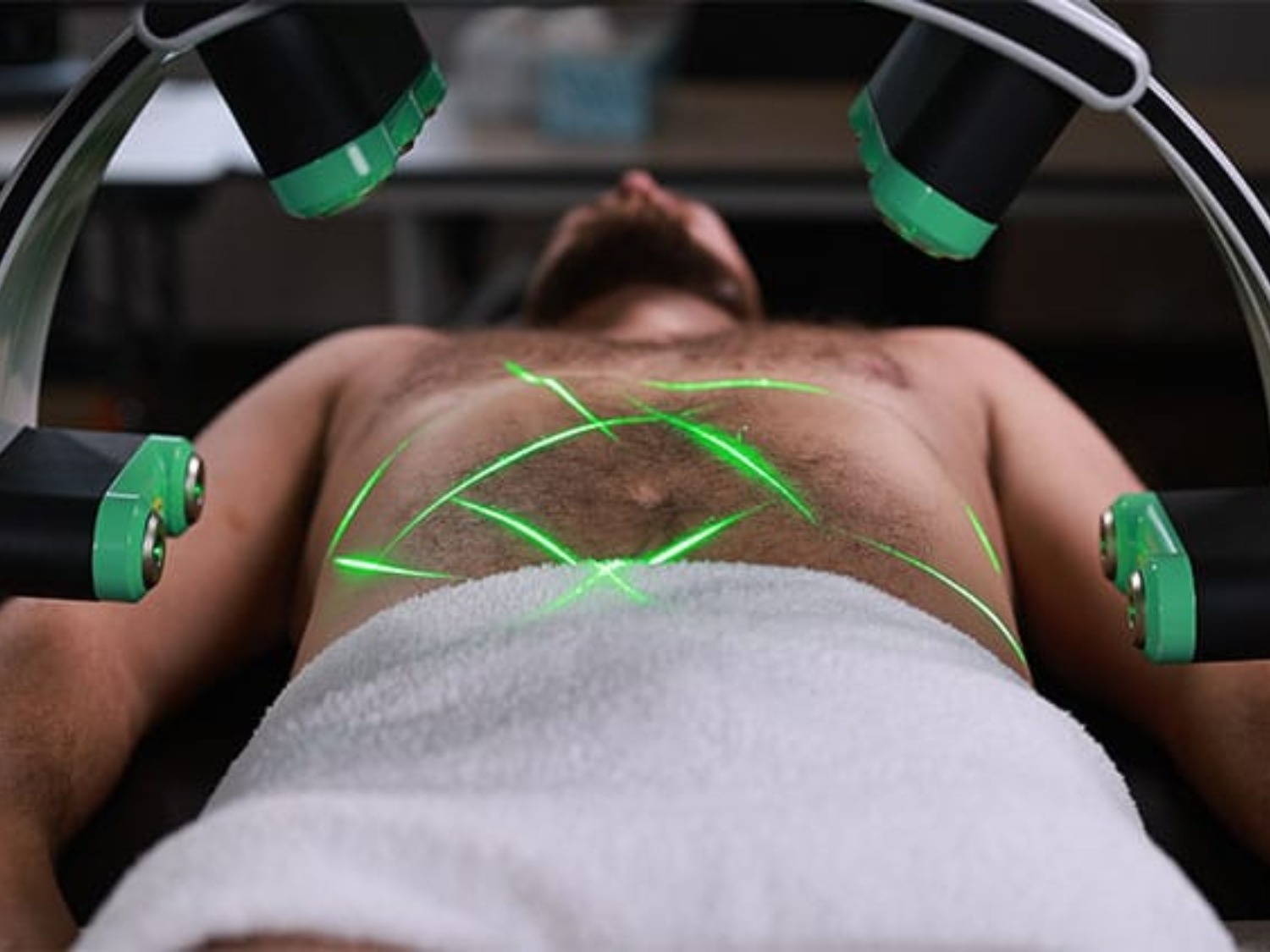 Emerald Laser-behandling på magen med gröna laserstrålar – HBC Borås