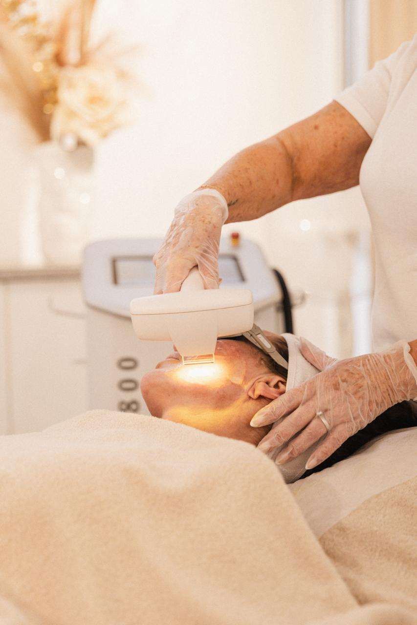 IPL Skin Rejuvenation mot rodnad och pigment på HBC i Borås