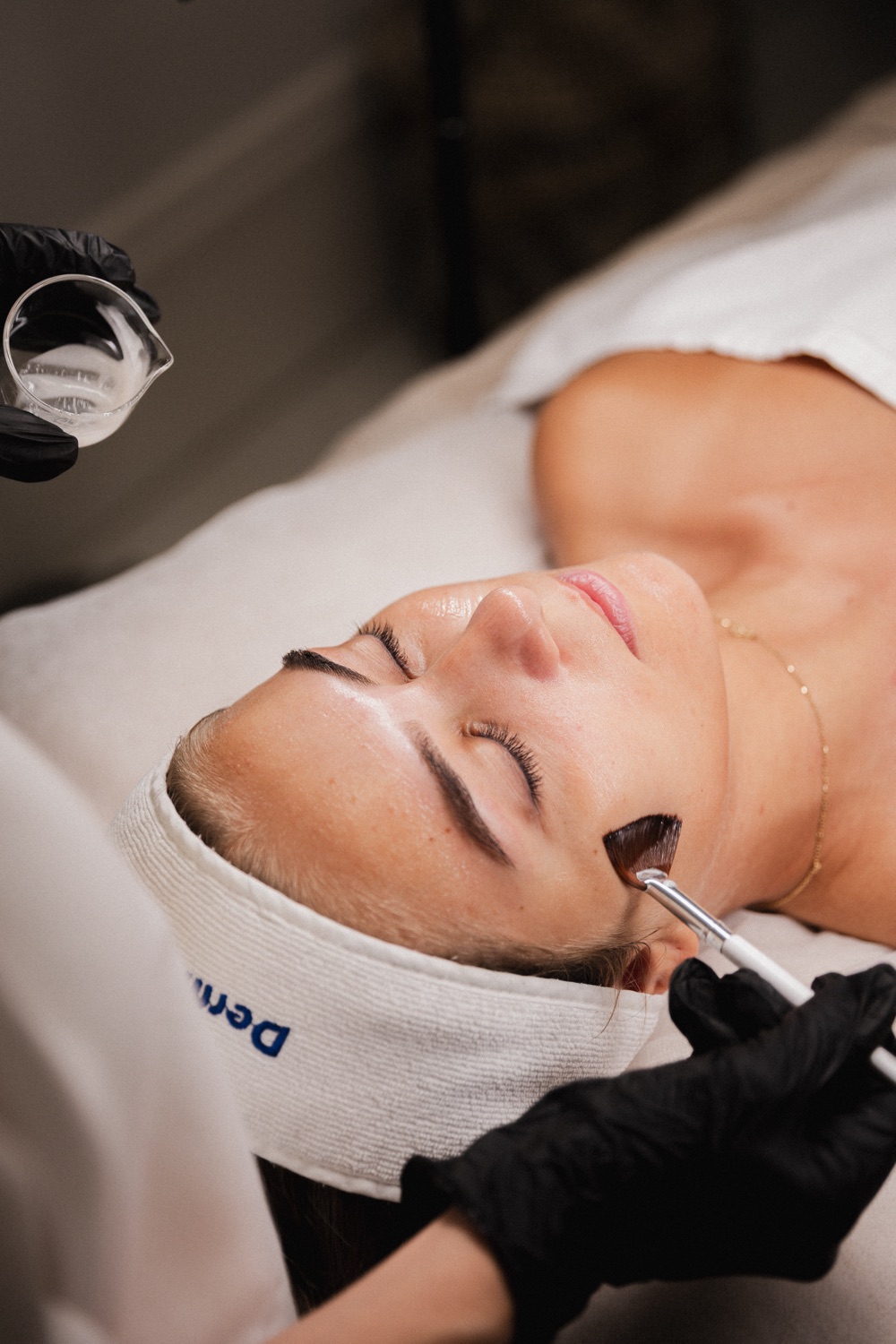 Dermaceutic kemisk peeling på HBC i Borås