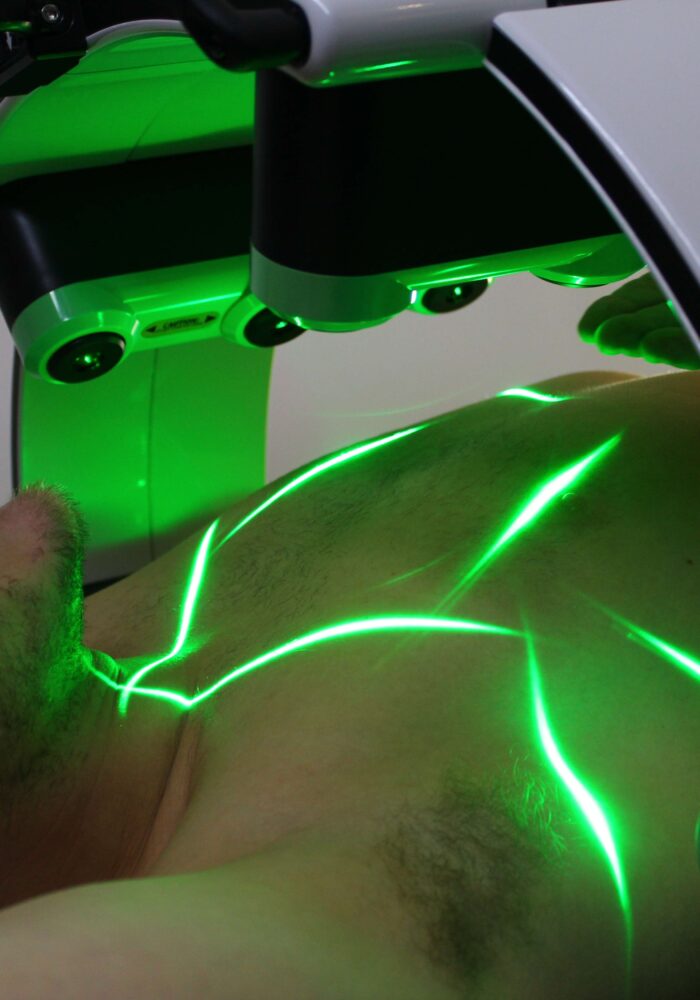 Emerald Laser-behandling